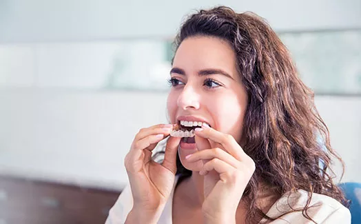 Woman inserting Invisalign clear aligner