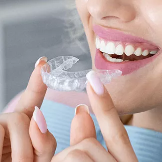 Woman inserting clear aligner